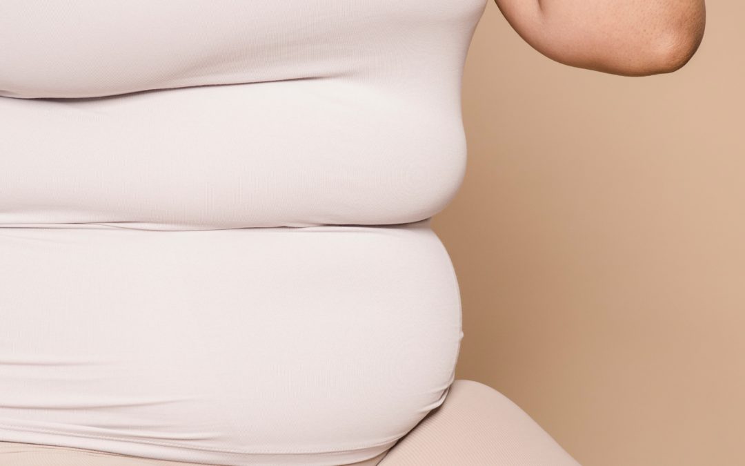 Leven met lipoedeem || Wie wil er nou obese zijn?